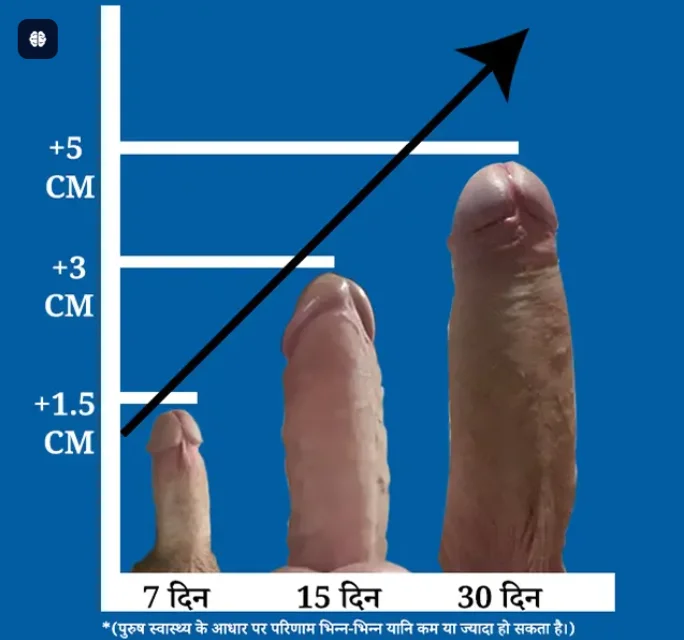 Growth Demonstration